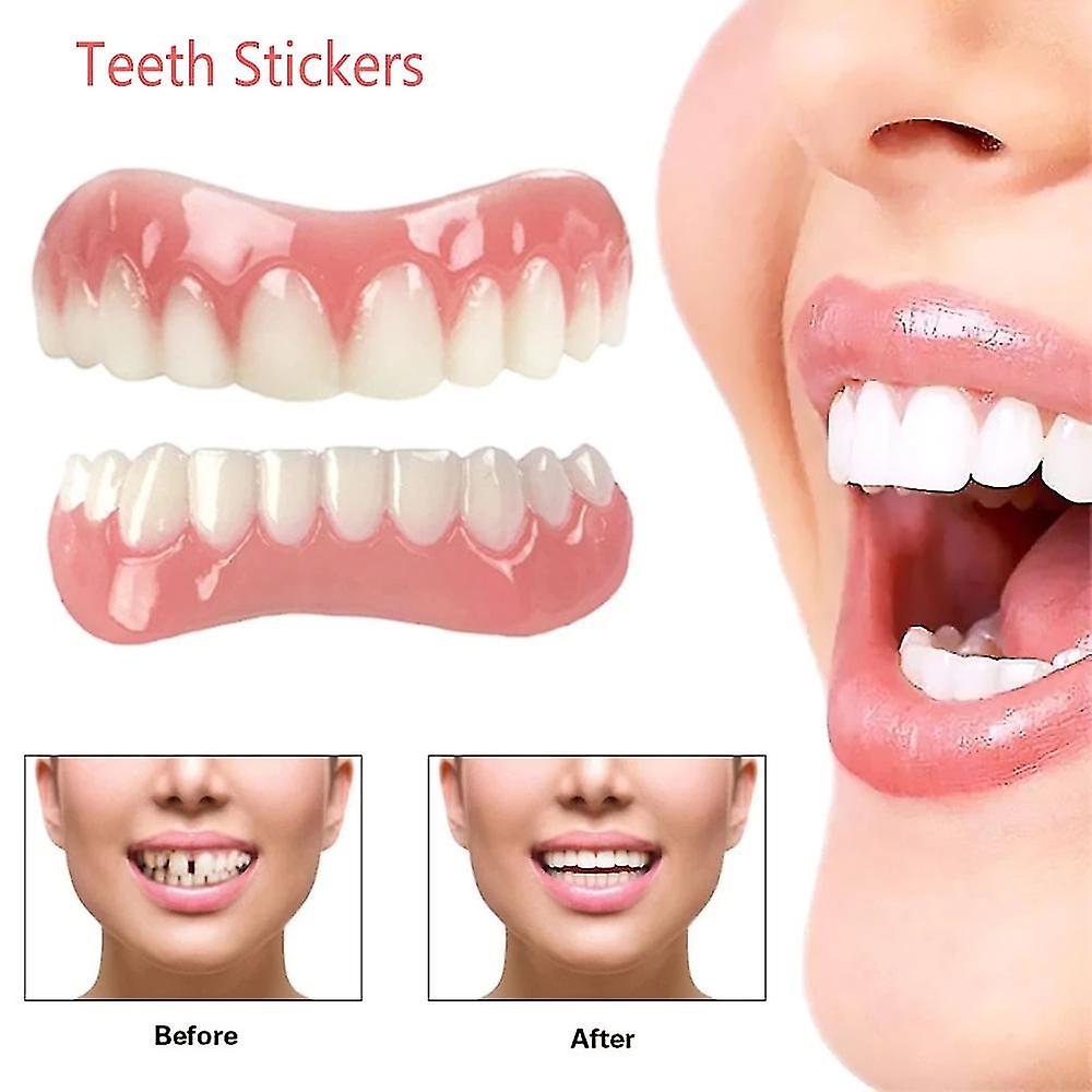 (Y)Extra Thin Fake Bright White Tooth Veneers Silicone Soft Safe Adhesive Denture Hide Shade Braces Comfortable Teeth Orthodontic